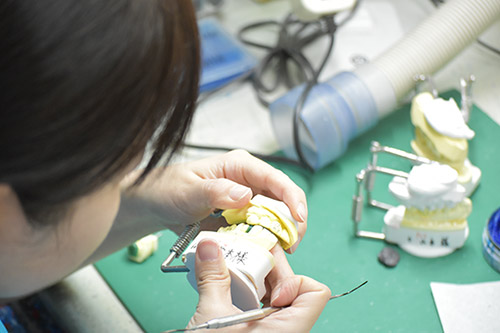 技工物の製作